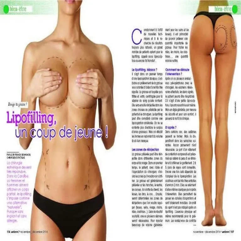 Lipofilling, un coup de jeune !