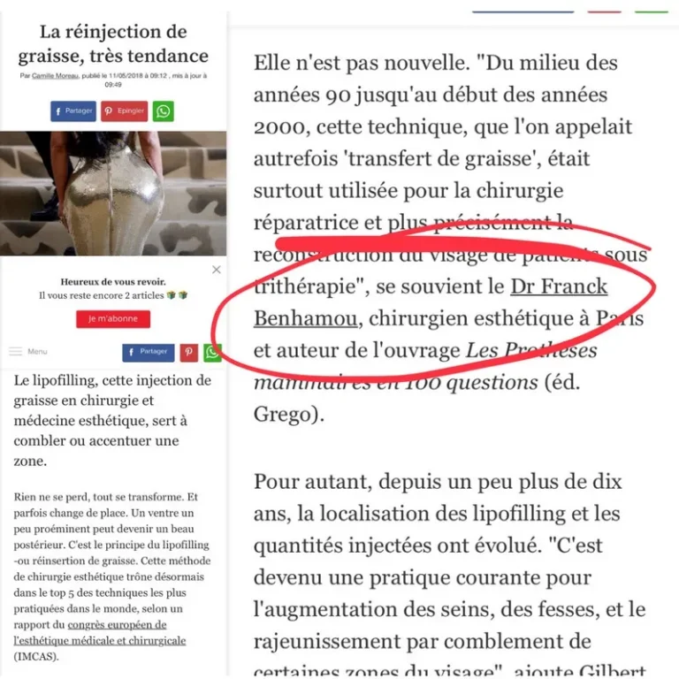 L'EXPRESS STYLES, la réinjection de graisse, très tendance