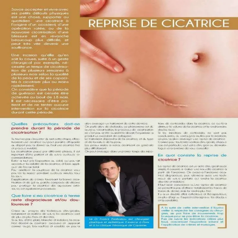 Reprise de cicatrice