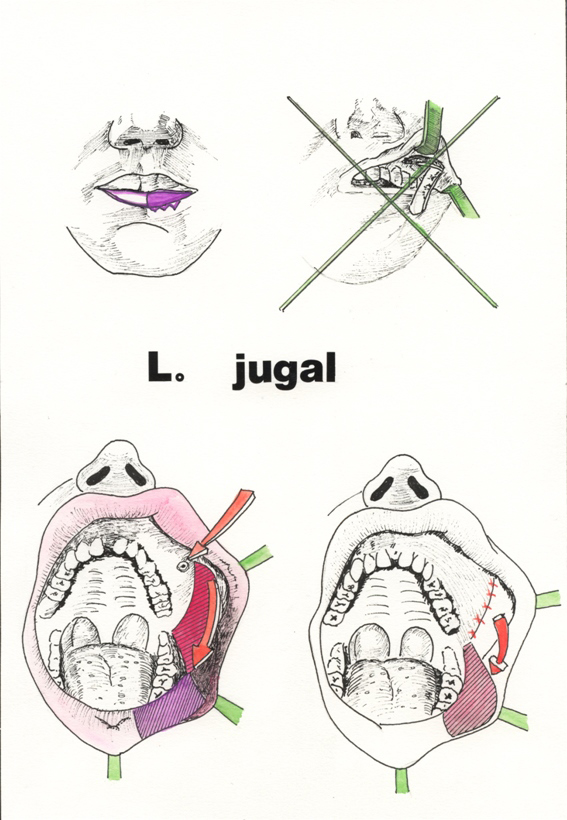 Lambeau Jugal