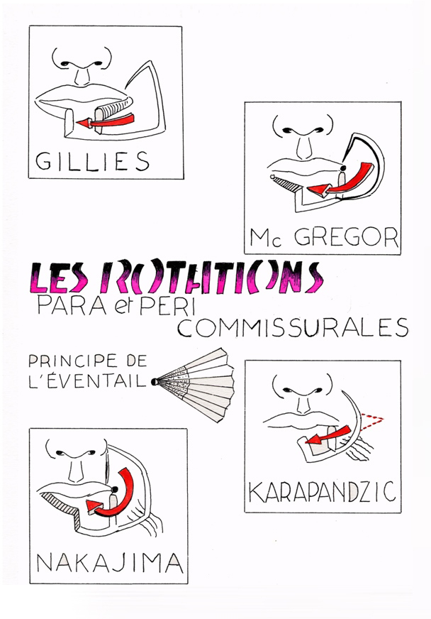 Les lambeaux de rotations - Para et Peri