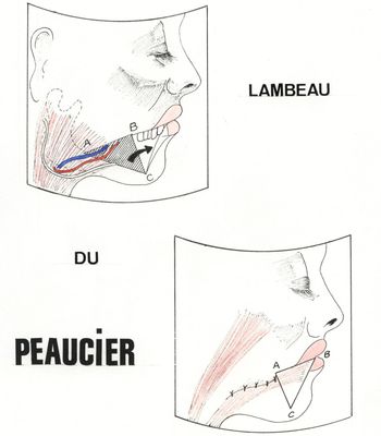 Lambeau du PEAUCIER