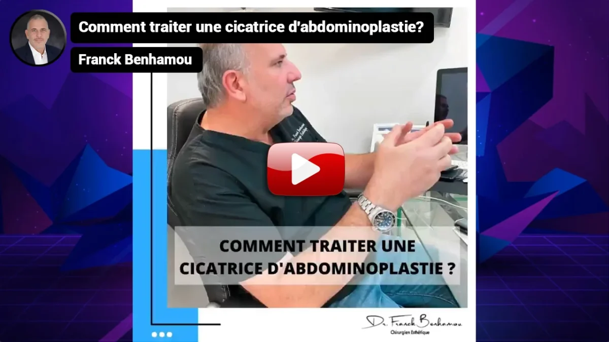 Comment traiter une cicatrice d'abdominoplastie.