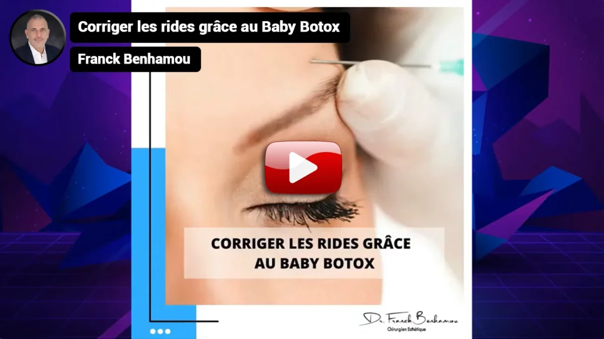 Comment corriger les rides grâce au Baby Botox.