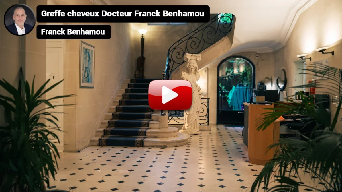 Greffe cheveux docteur franck benhamou.
