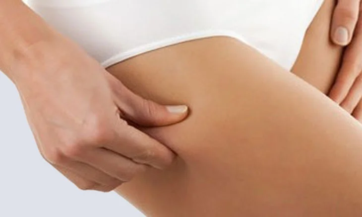 Chirurgie de la silhouette 1
