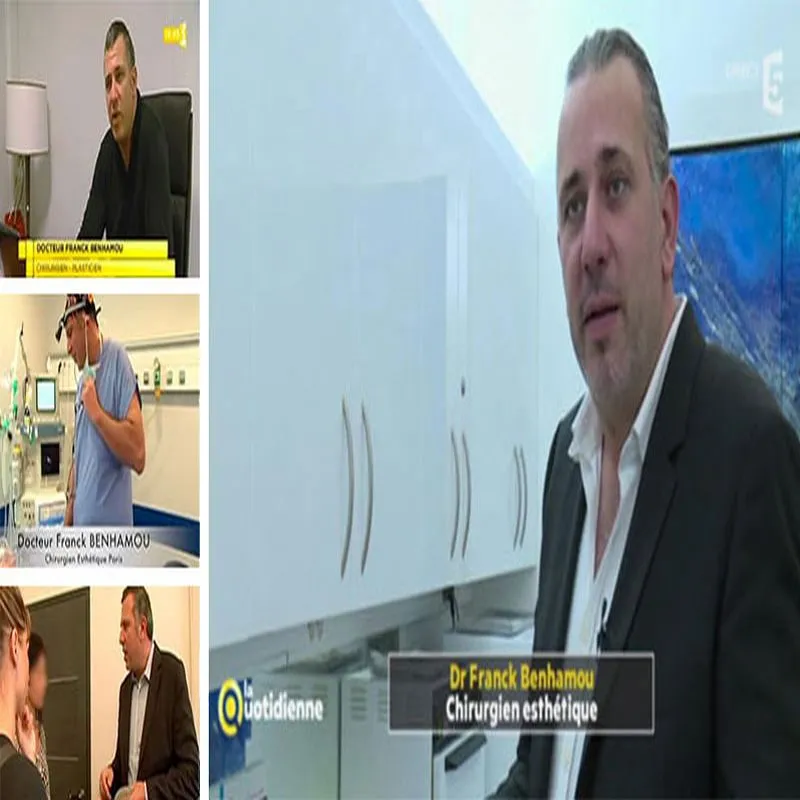 apparition tv franck benhamou chirurgie esthetique